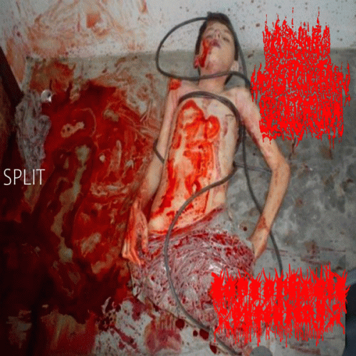 Coprophagic Dysentery : Coprophagic Dysentery - Orgasmic Menstruation Bloodcum